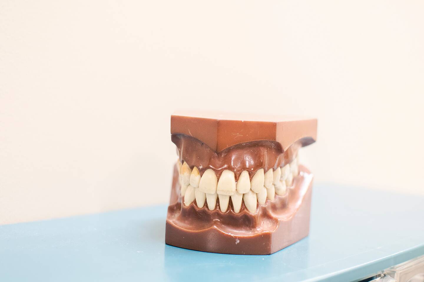 Dental Impressions